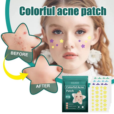 112pcs Pimple Patches Fade Face Spot Repair Star Shaped Pimp